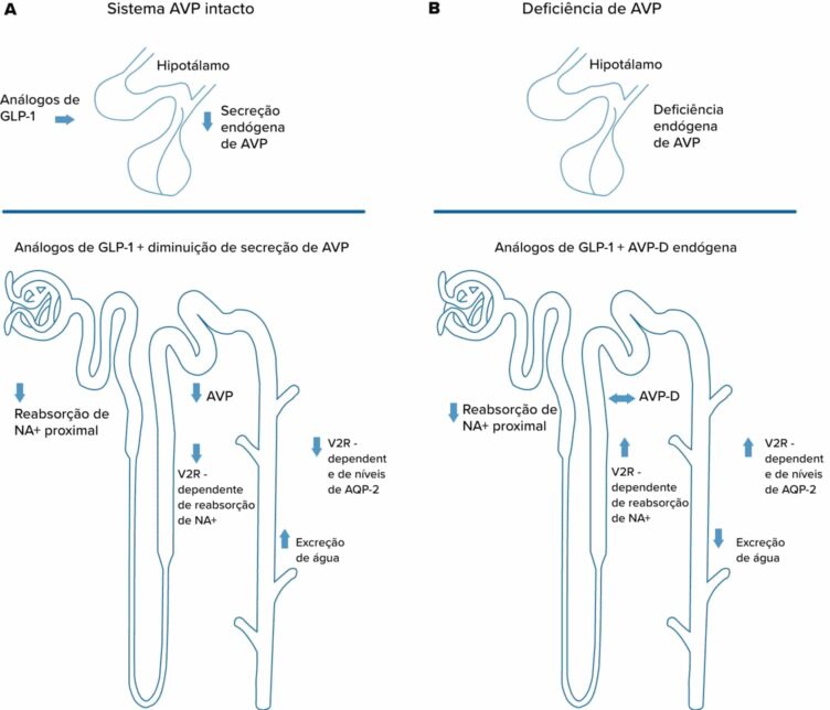 sistema-avp sistema-avp